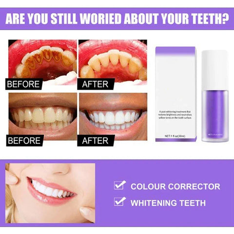 Teeth Colour Corrector Serum